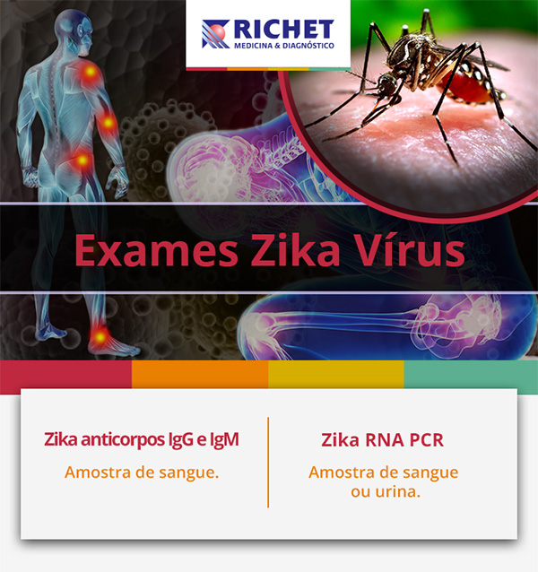 Laboratorio Richet - Exames Zika Virus
