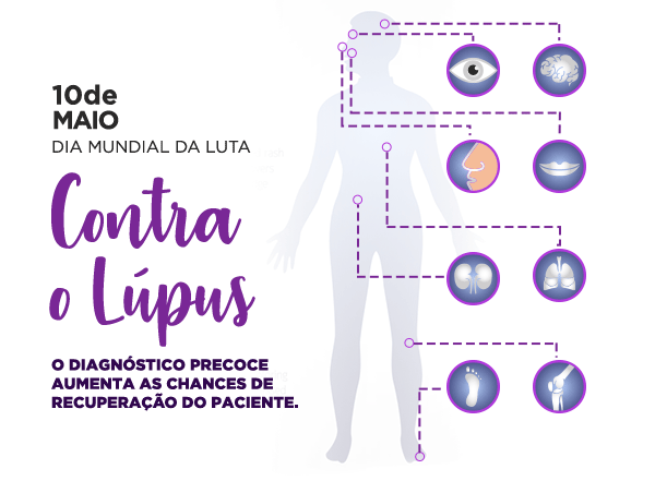 Richet - Dia Mundial da Luta contra o Lúpus