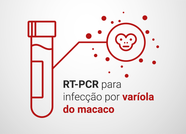 RT-PCR para infecção por varíola do macaco.