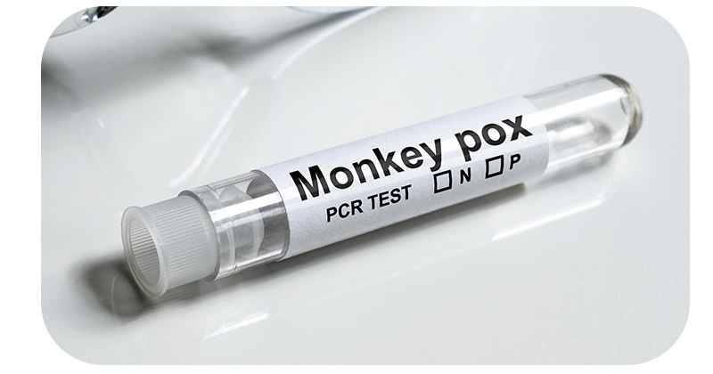 Monkey Pox, PCR Test.